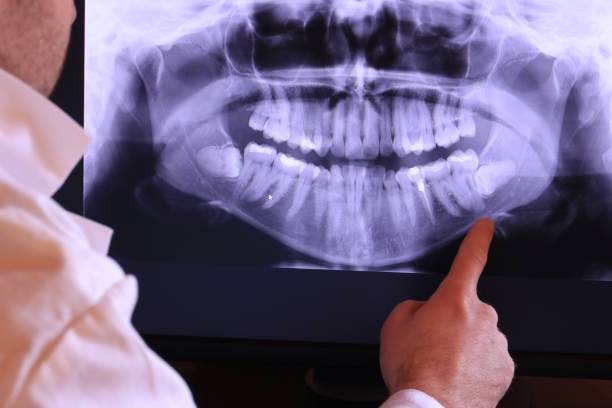 Best Emergency Root Canal Treatment in Rocky River, OH