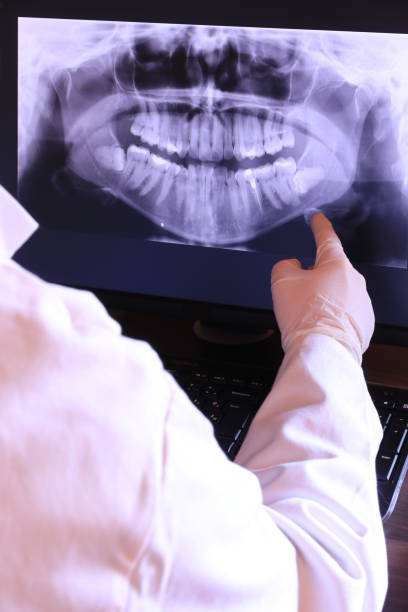 Best Emergency Broken Tooth Repair in Rocky River, OH