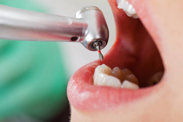 Best Emergency Treatment for Toothache in Rocky River, OH